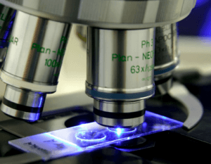 Navrongo Research Centre diagnoses 100 children with sickle cell disease Navrongo Research Centre diagnoses 100 children with sickle cell disease